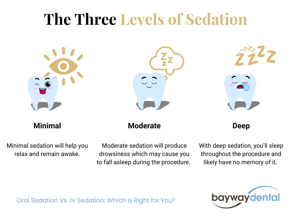 3 levels of sedation