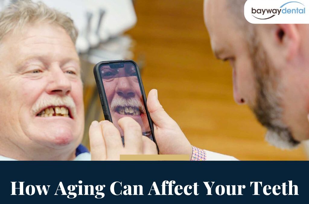 How Aging Can Affect Your Teeth