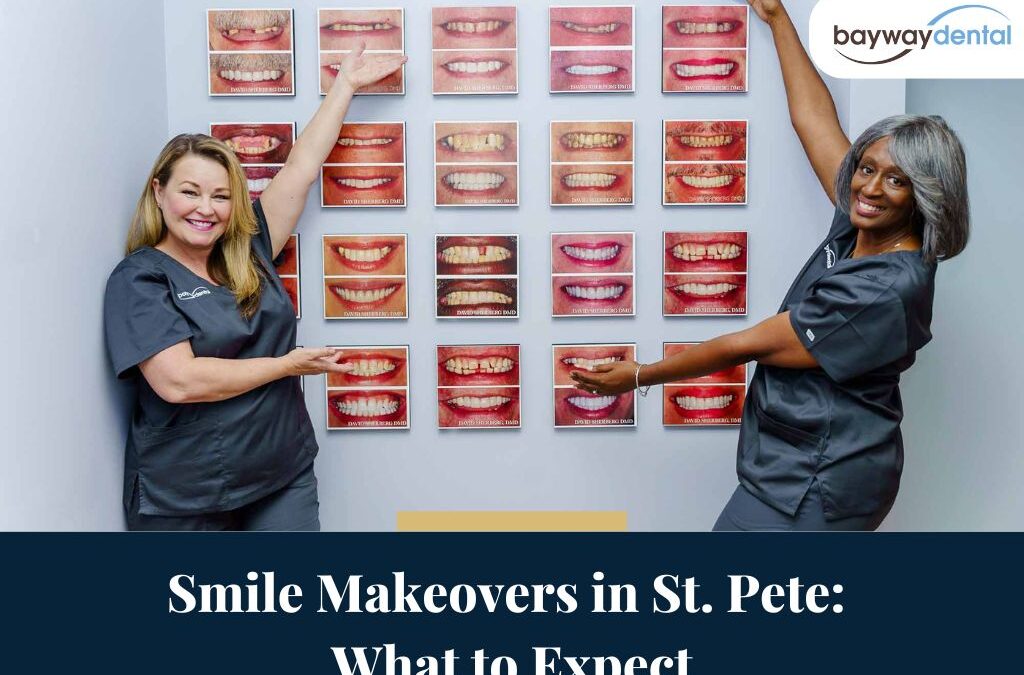 Smile Makeovers in St. Pete: What to Expect