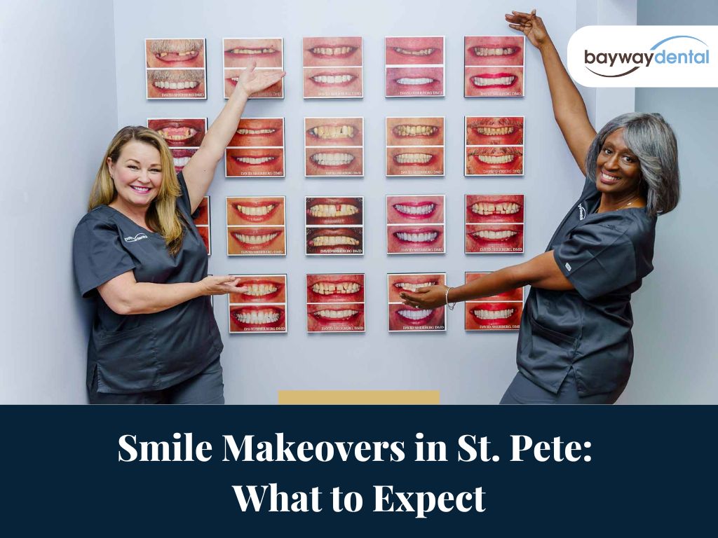 Smile Makeovers in St. Pete: What to Expect